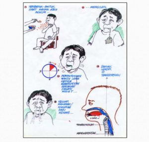 Prosedur Skrining Disfagia (Modifikasi Dari The Massey Bedside Swallowing Screen)