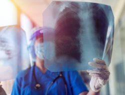 Memahami Konsep Asuhan Keperawatan Pada Pasien Tuberkulosis