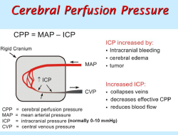 Standar Prosedur Operasional (SPO) Keperawatan:  Pemantauan CPP (Cerebral Perfusion Pressure)