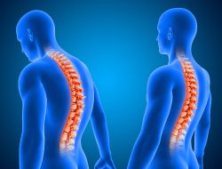 Mengenal Penyakit Spinal Muscular Atrophy