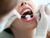 SAP (Satuan Acara Penyuluhan) Tentang Menjaga Kesehatan Gigi dan Cara Menggosok Gigi