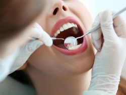 SAP (Satuan Acara Penyuluhan) Tentang Menjaga Kesehatan Gigi dan Cara Menggosok Gigi