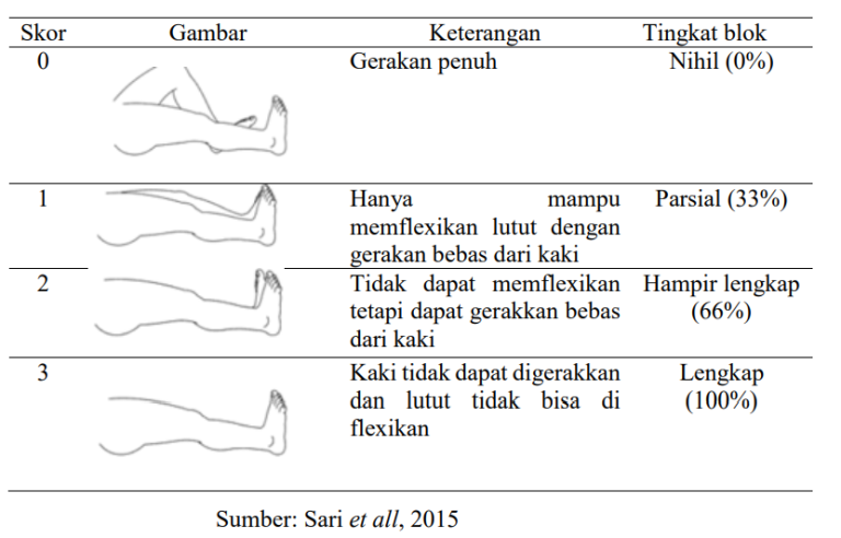 Kriteria Penilaian Bromage Score Pada Pasien Post Operasi Spinal ...