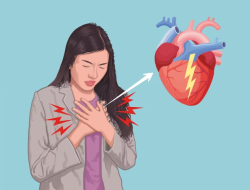 Askep Sistem Kardiovaskuler : Angina Pectoris