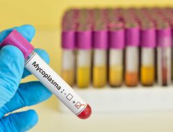 Telah Ditemukan di Indonesia, Dokter Sebut Mycoplasma Pneumoniae Memiliki Fatalitas Lebih Rendah dari Covid-19