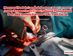 Mengenal Bedah Cangkok Jantung atau Coronary Artery Bypass Graft (CABG) Sebagai Penanganan Penyakit Jantung Koroner (PJK) yang Parah