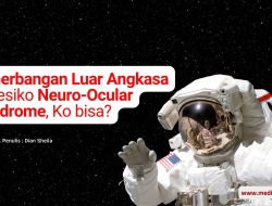 Penerbangan Luar Angkasa Beresiko Neuro-Ocular Syndrome, Ko bisa?
