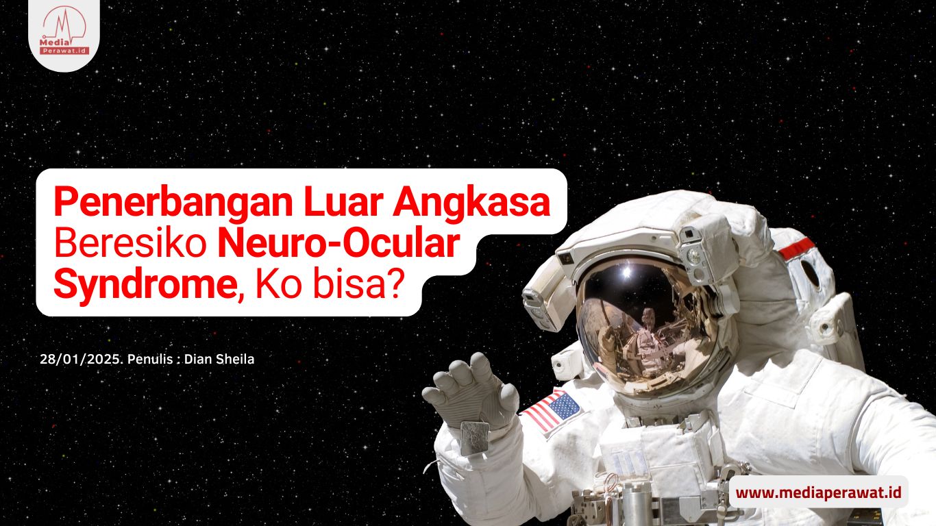 Penerbangan Luar Angkasa Beresiko Neuro-Ocular Syndrome