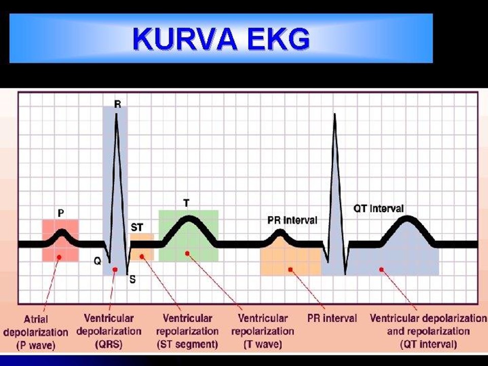 Cara Membaca EKG dengan Mudah (5)