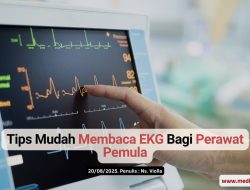 Tips Mudah Membaca EKG Bagi Perawat Pemula