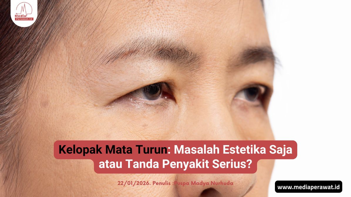 Kelopak Mata Turun_Ptosis
