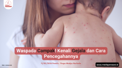 Waspada Campak! Kenali Gejala dan Cara Pencegahannya