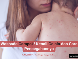Waspada Campak! Kenali Gejala dan Cara Pencegahannya