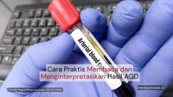 Cara Praktis Membaca dan Menginterpretasikan Hasil AGD