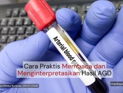 Cara Praktis Membaca dan Menginterpretasikan Hasil AGD
