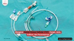 Mengenal Central Venous Catheter (CVC) Fungsi, Jenis, Indikasi, dan Perawatannya
