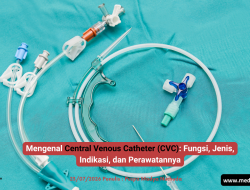 Mengenal Central Venous Catheter (CVC): Fungsi, Jenis, Indikasi, dan Perawatannya